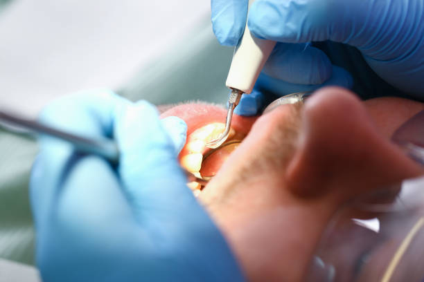 Best Urgent Care for Lost Fillings or Crowns in Lake City, GA