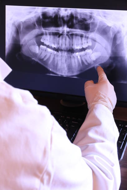 Best Emergency Denture Repair in Lake City, GA